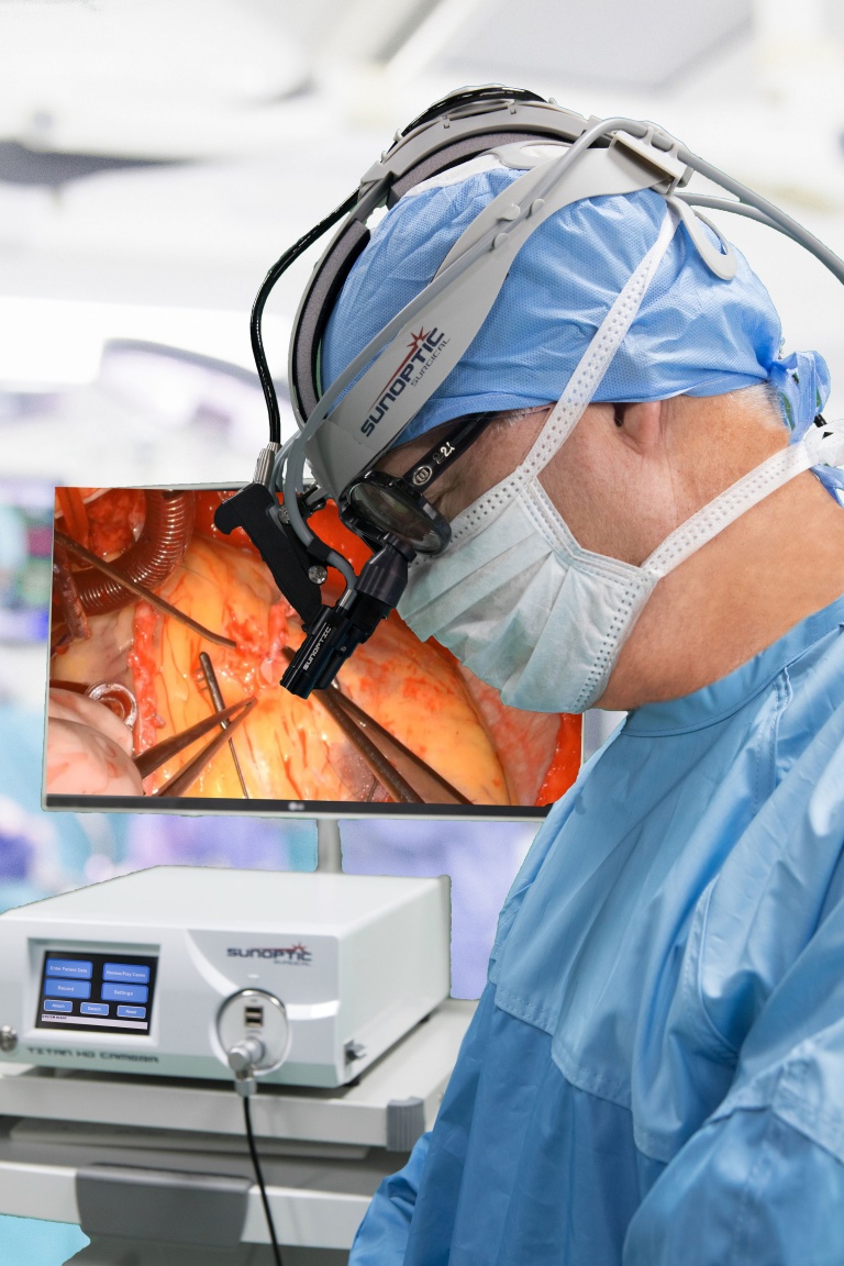 Surgical Camera & Headlight System: Sunoptic HDC-300 HD