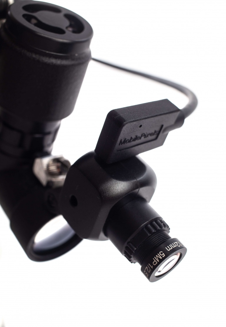 Endoscope médicaux USB portable Caméra vidéo pour l'Orl