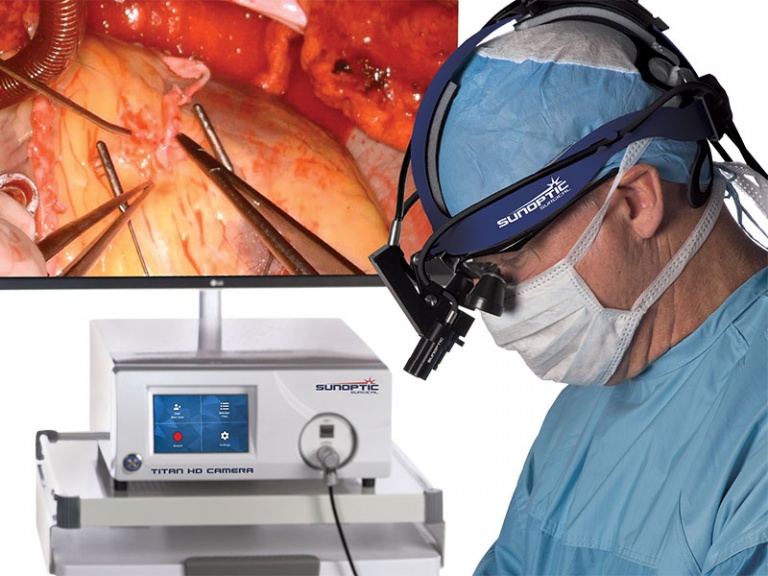 HD Surgical Camera