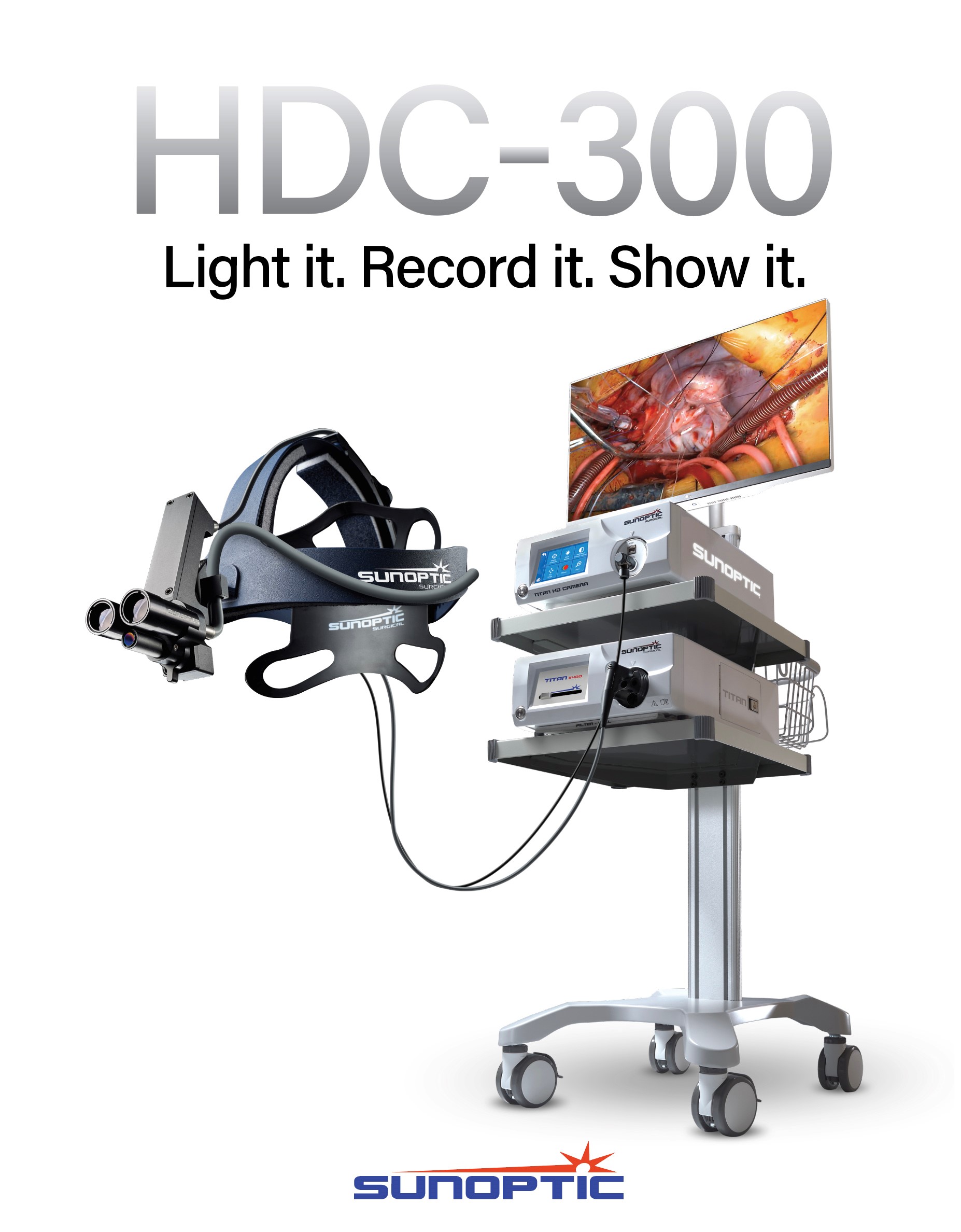 Sunoptic HD Camera Headlight System for Surgery Brochure